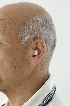 宇都宮で歯列矯正の選択肢が多い歯科医院