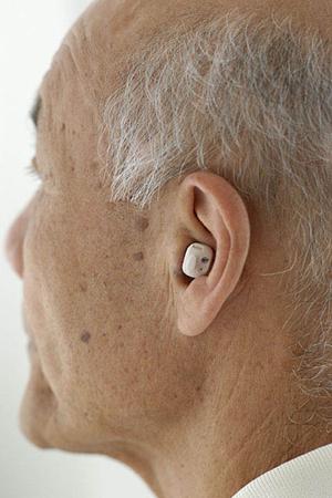 口呼吸も歯並びやかみ合わせに影響する