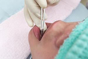 東京でインプラント治療をするなら