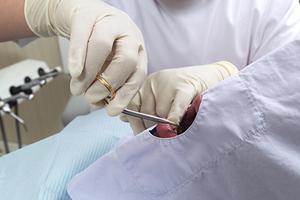 矯正に特化した矯正専門歯科がオススメ