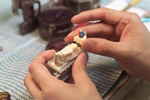 歯周病治療に対応している歯医者