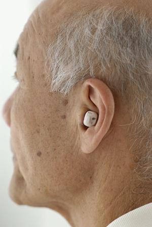 静岡市で選ぶ！目立たないマウスピース矯正のメリットと最適な治療法